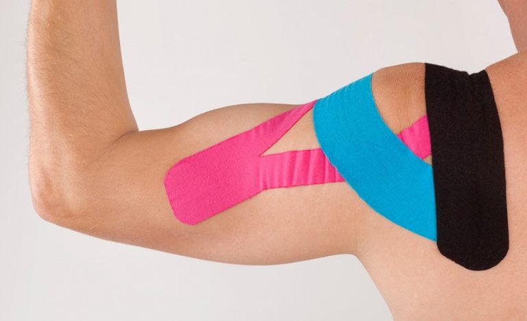 que-es-el-kinesiotape-768x469